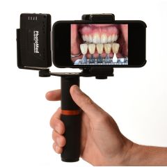 SDL - Smartphone Dental Light 